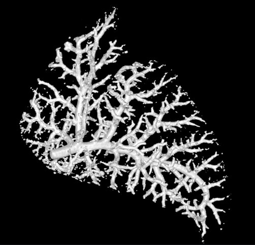 Skeleton network of blood vessels within a healthy lung